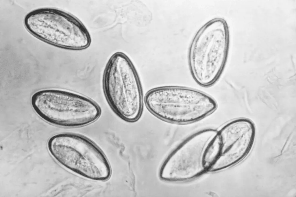 Microscope image of pinworm eggs.