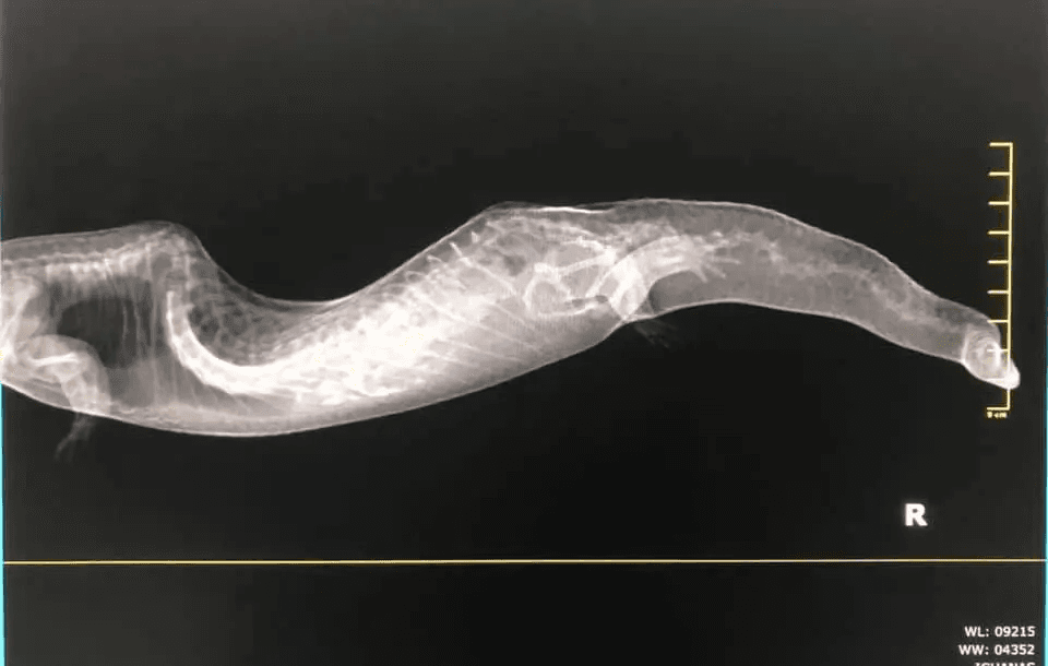 x-ray of bts with spinal deformity